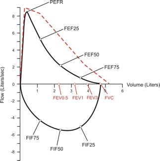 Flow Volume Loop