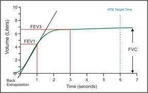 FVC Volume Time Graph