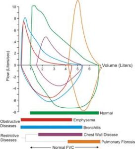 Pulmonary Function Tests - Morgan Scientific Pulmonary Function Testing ...
